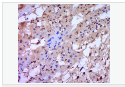 60580608b12af.png image.png