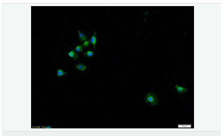 60594acee4095.png image.png