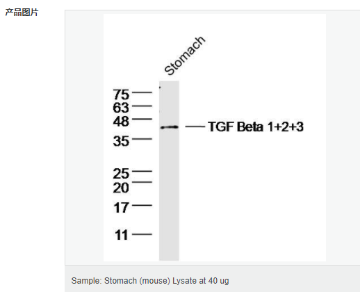 605d848e3e898.png image.png