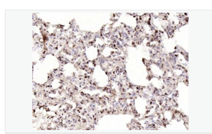 6076493326a9d.png image.png