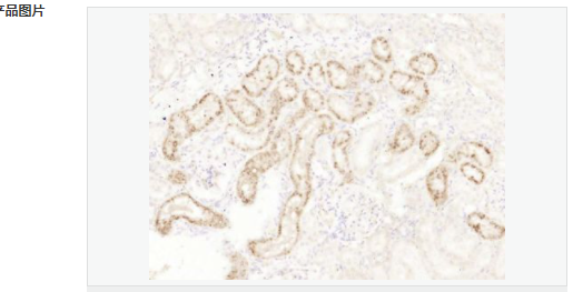 60764a2a0f513.png image.png